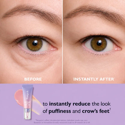 Fempick Eye Bag Instant Eraser, Tightens, Firms, & Blurs Wrinkles