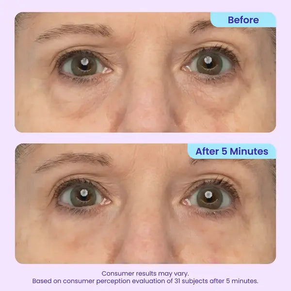 Fempick Eye Bag Instant Eraser, Tightens, Firms, & Blurs Wrinkles