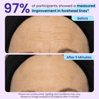 Fempick Eye Bag Instant Eraser, Tightens, Firms, & Blurs Wrinkles