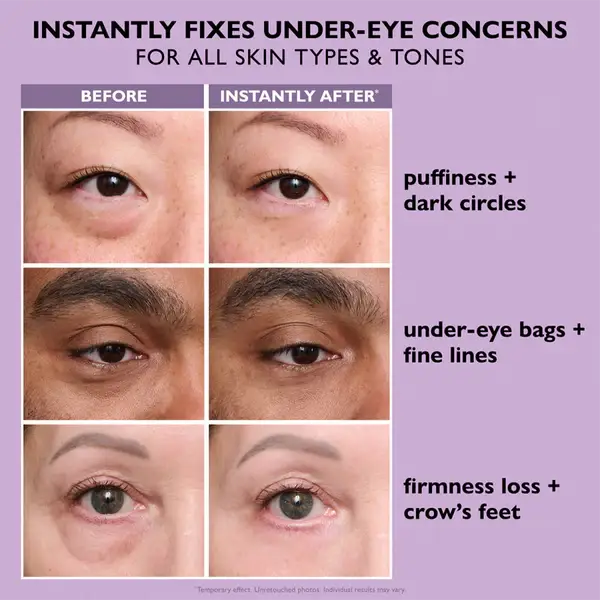 Fempick Eye Bag Instant Eraser, Tightens, Firms, & Blurs Wrinkles